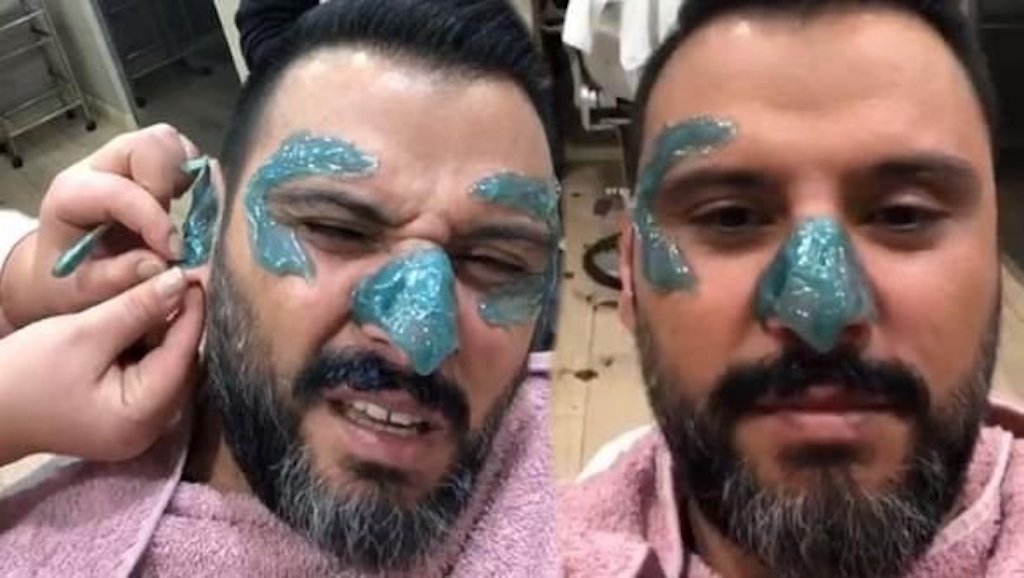 Alişan ağda yaptırdı!