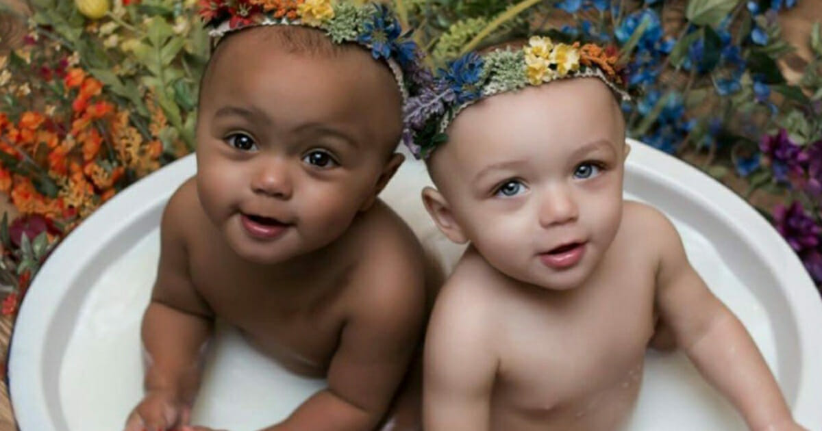 Bakın Dünyanın Farklı Ten Rengindeki İlk İkizleri Bugün Nasıl Görünüyor