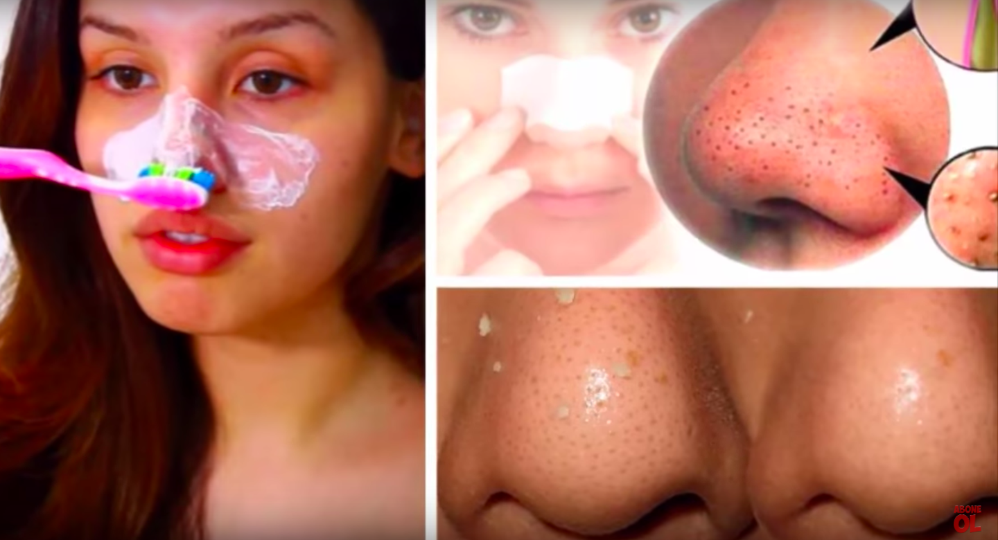 Diş Macununu Burnunuza Sürün ve İnanılmaz Birşey Olacak İNANILMAZ =>>>