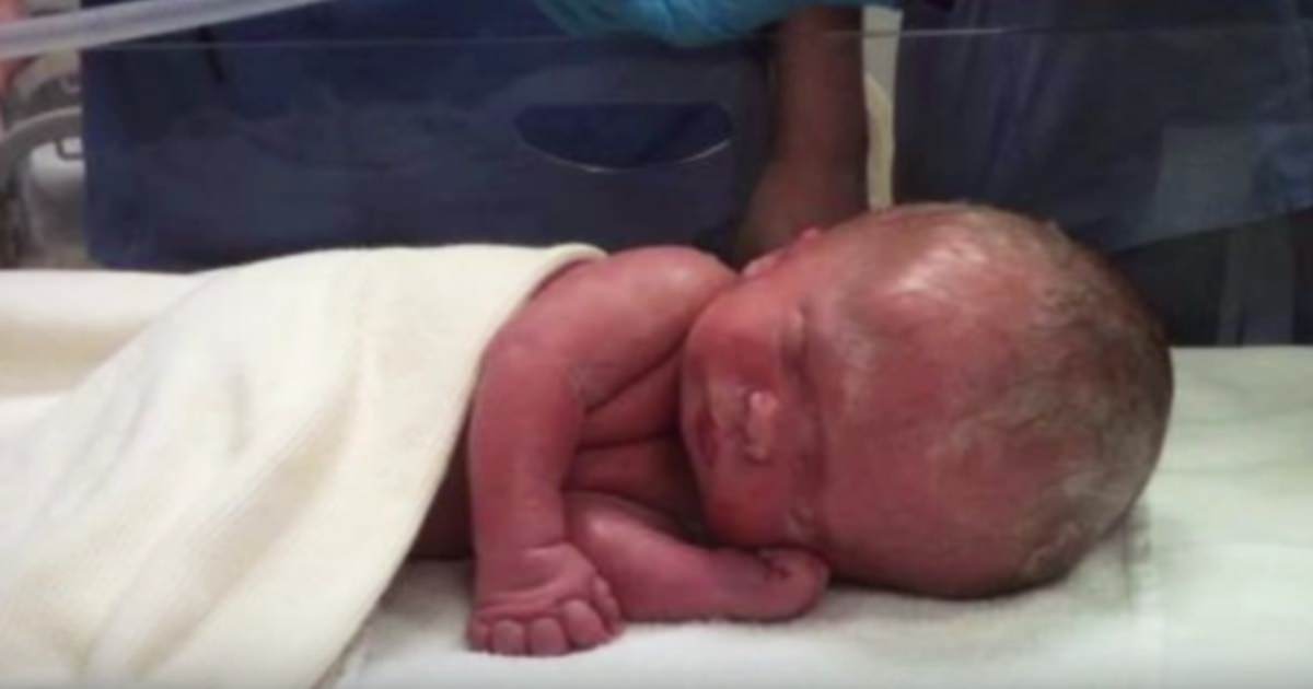 Doktorlar Beyni Oluşmadığından Anneye Bebeği Almayı Önerdi – 4 Yıl Sonra İse Doktorlar Şok Oldu