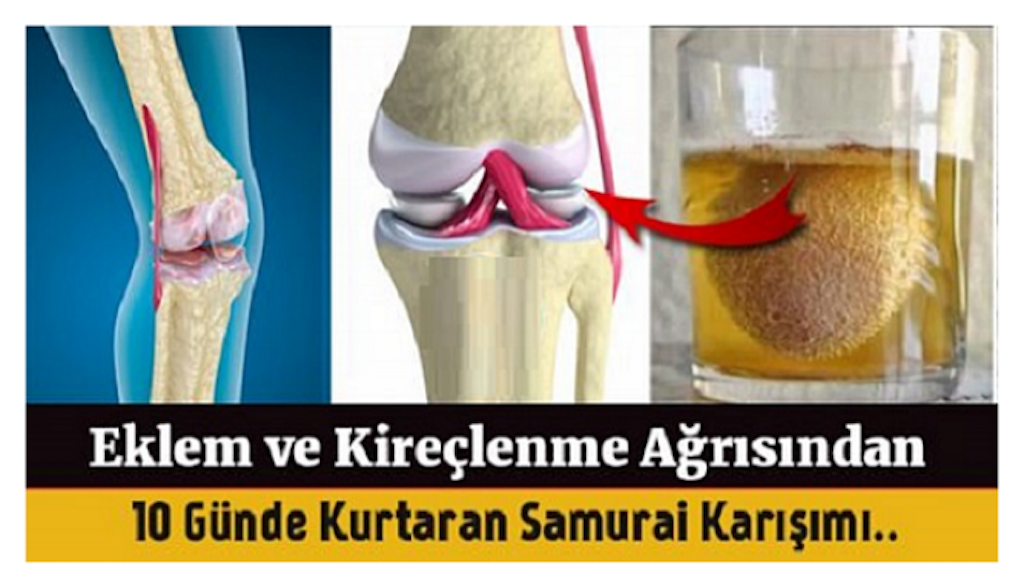 Eklem ağrılarını gideren elma sirkesi yumurta kabuğu tedavisi!