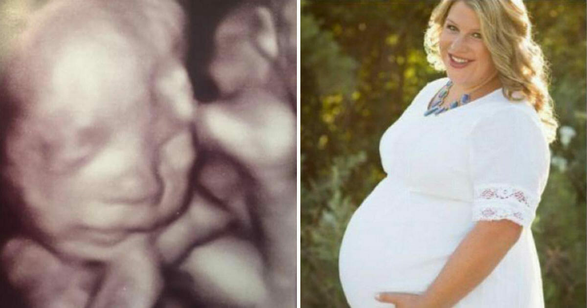 Eşinin Vefatının Ardından Hamile Olduğunu Öğrendi – Ultrasonda Gördüklerine İnanamadı