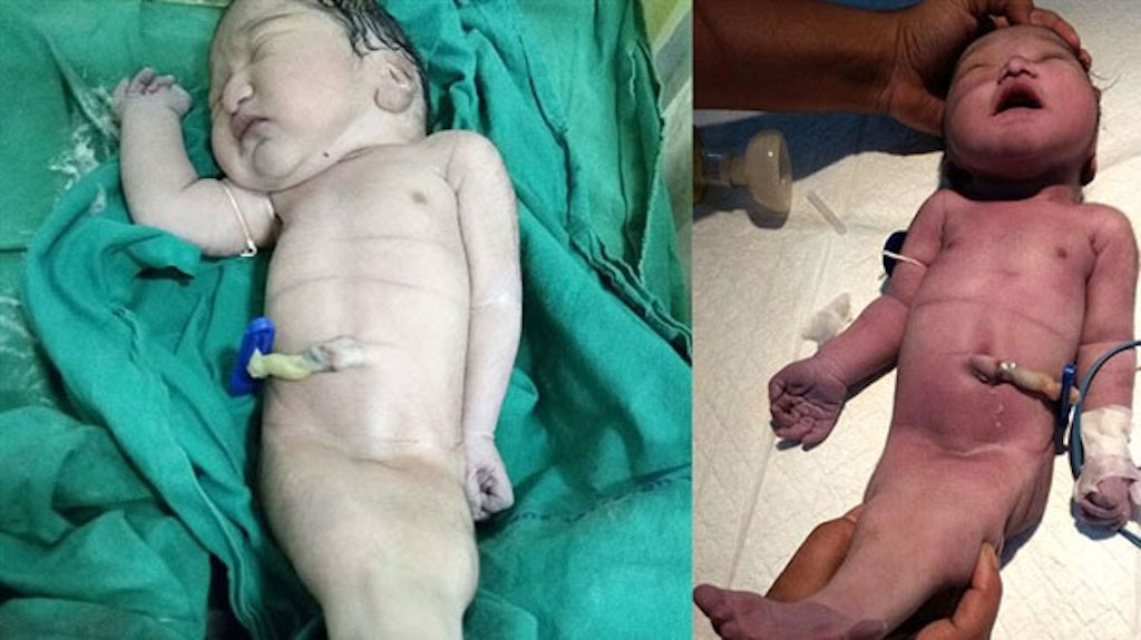 Hindistan’ın ‘deniz kızı’ 4 saat yaşadı