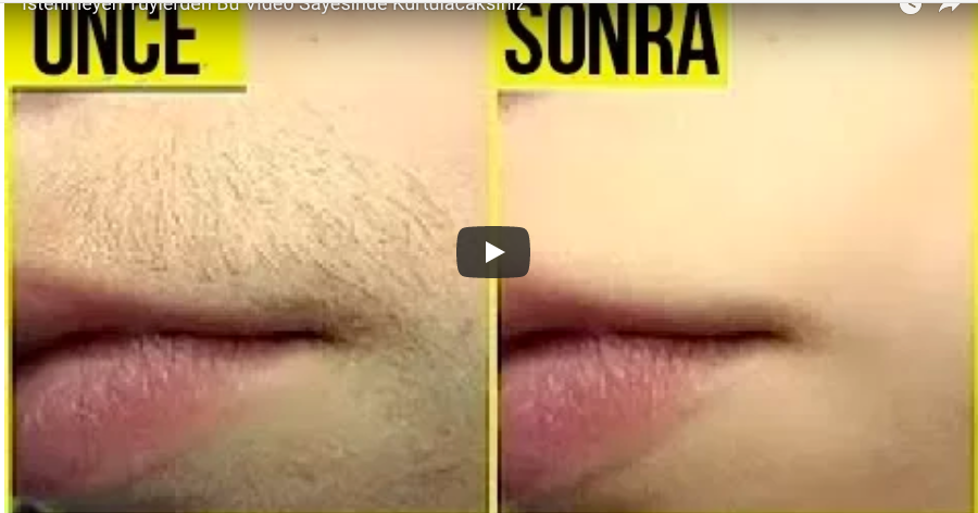 İstenmeyen Tüylerden Bu Video Sayesinde Kurtulacaksınız =>> HEMEN İZLEYİN