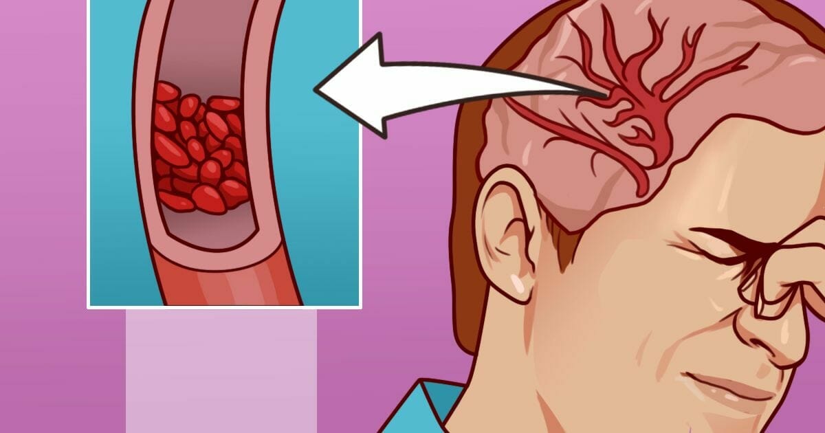 Magnezyum Takviyesine İhtiyacınız Olduğunun 12 Belirtisi =>>