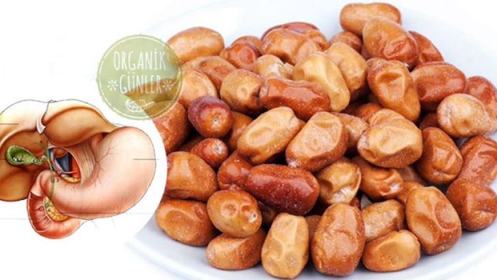 Safra Kesesi Taşına İğde Kürü.. =>>>