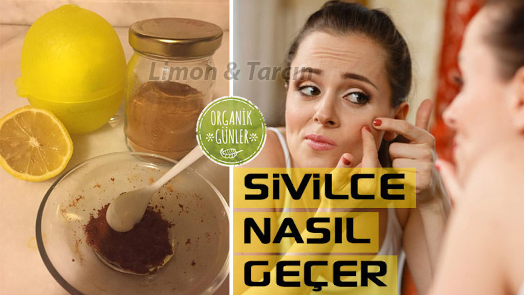 Sivilceye Karşı Tarçın Limon Karışımından Maske =>>>