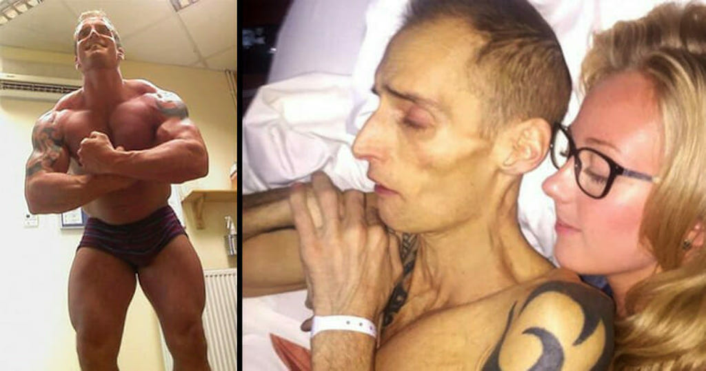 Vücut Geliştiricisinin Ölüm Nedenini Duyunca İnanamayacaksınız =>>