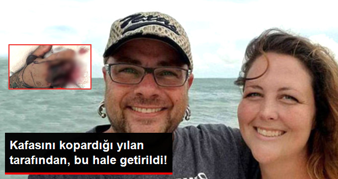 Genç Adam Kafasını Kestiği Yılan Tarafından Isırıldı, Ölümden Döndü