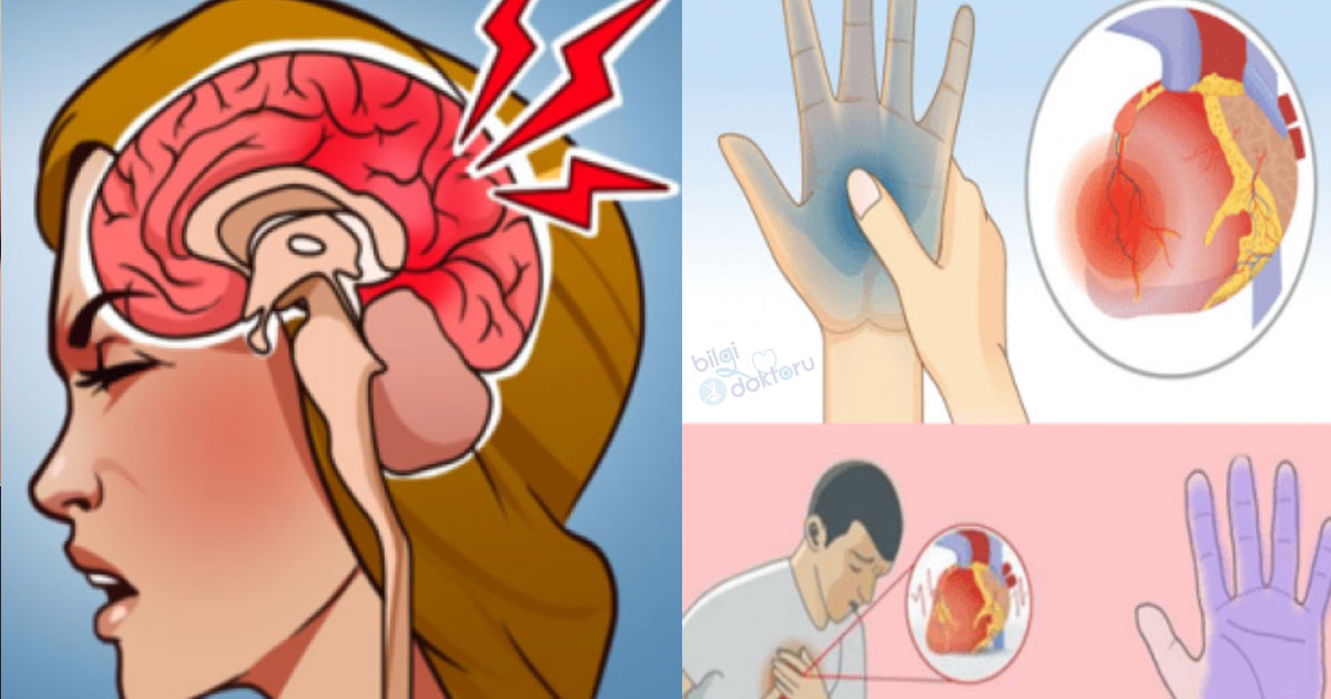 Magnezyum Eksikliği Nasıl Anlaşılır?