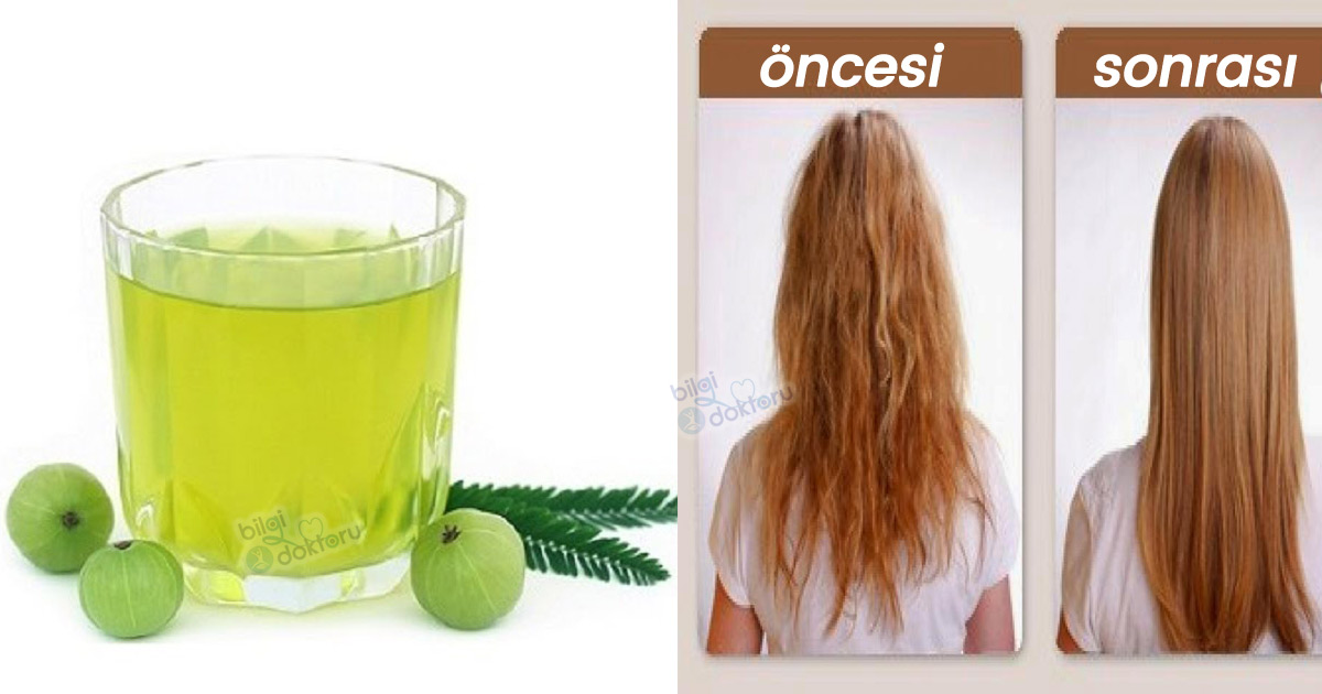 Amla Yağı Nedir, Nasıl Kullanılır?