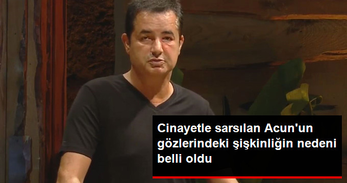 Acun Ilıcalı’nın Gözündeki Şişliğin Nedeninin Enfeksiyon Olduğu Ortaya Çıktı