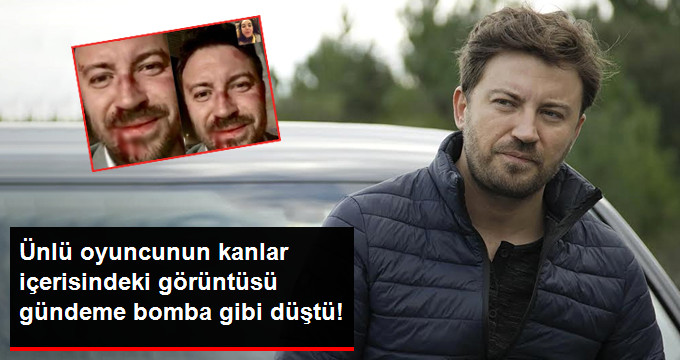 Ünlü Oyuncu Tolga Güleç’in Kanlar İçerisindeki Görüntüsü Gündeme Bomba Gibi Düştü