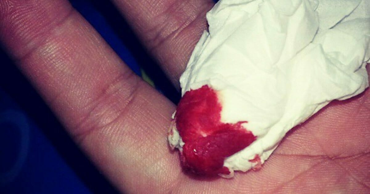 Yüksek Tansiyon Hastası Olduğunuzun 9 Kanıtı