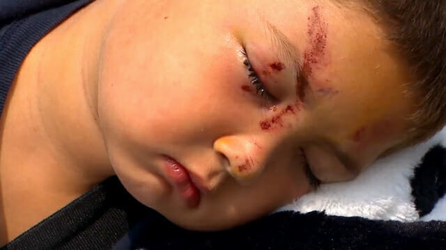 Zorbalığa Uğrayan Arkadaşını Kurtarmaya Çalışan 6 Yaşındaki Çocuğun Başına Bakın Neler Geldi