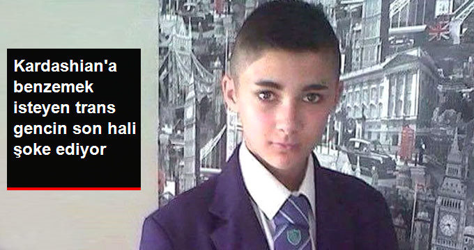 KİM KARDASHİAN’A BENZEMEK İSTEYEN TRANS GENCİN SON HALİ ŞOKE ETTİ