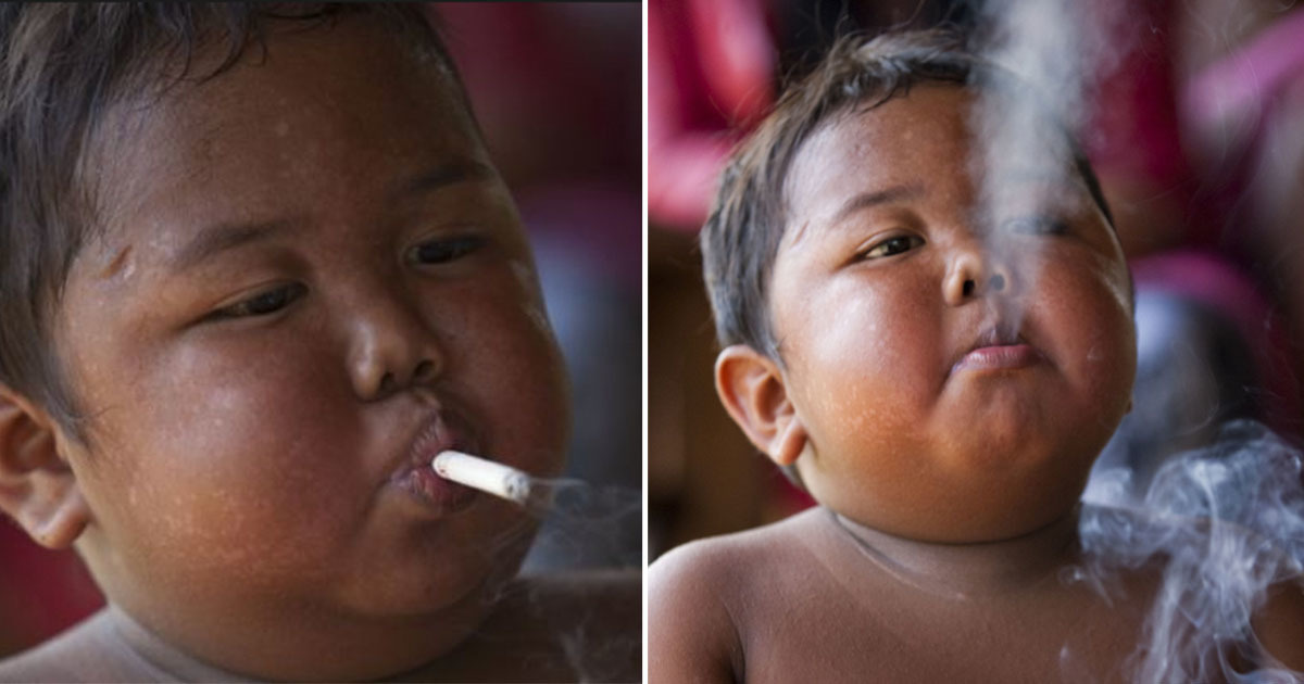 İki Yaşındayken Günde 2 Paket Sigara İçen Çocuk 6 Yılda Bakın Ne Hale Geldi