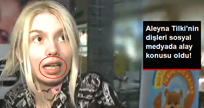 Ünlü Şarkıcı Aleyna Tilki’nin Dişleri, Sosyal Medyada Alay Konusu Oldu