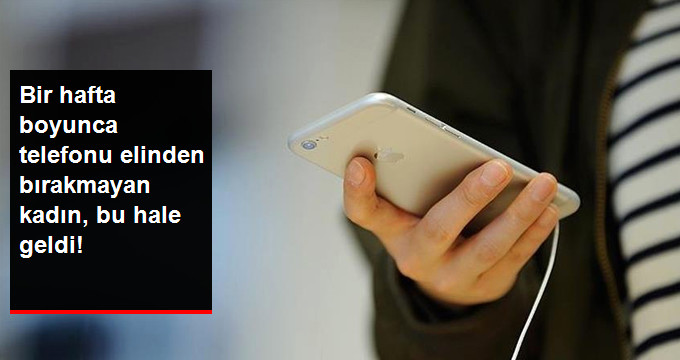 Bir Kadın, 1 Hafta Boyunca Telefonu Elden Bırakmayınca Parmaklarını Kullanamaz Hale Geldi