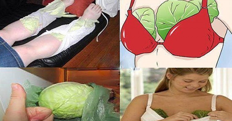 Lahana Yaprağı Mucizesi