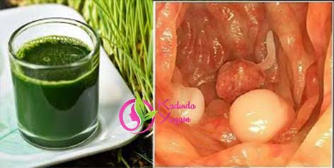 KANSERİN ÖLÜMÜ–MUTLAKA OKUYUN