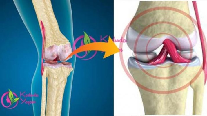 DOKTORLAR ŞOKTA! 2 HAFTADA EKLEMLERİ YENİDEN DOĞMUŞ GİBİ YAPIN!