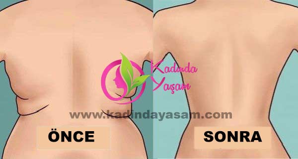 BUZ TORBASI İLE GÖBEK ERİTME