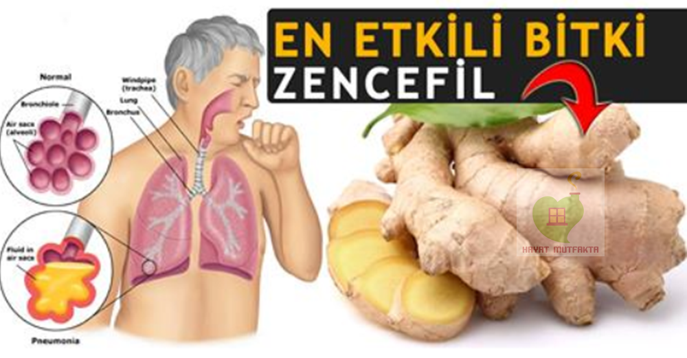 Gribe ve Nezleye Bal Zencefil Limon Kürü