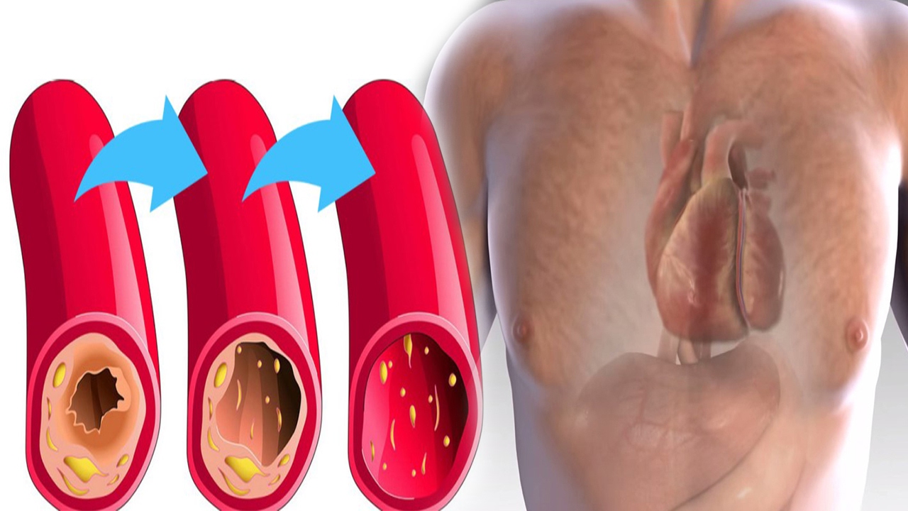Doktorlar bile bunu tavsiye eder! Tüm kürlerden daha güçlü!