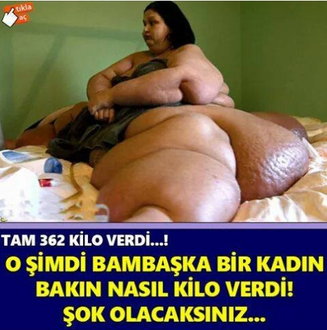 Dünyanın en şişman kadınıydı.
