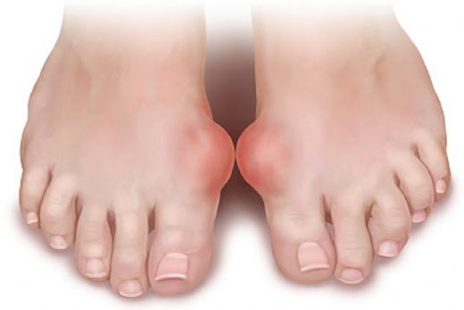 Gut Hastalığını Tamamen İyileştiren Çok Güçlü Doğal Sağlıklı Bir Karışım