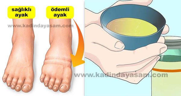 Ödem söktürücü tarifler