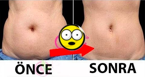 Bu İçeceği Her Sabah Boş Bir Mideye içti Ve Göbek Yağına Veda etti! Şişkinlikten sonsuza kadar kurtuldu!