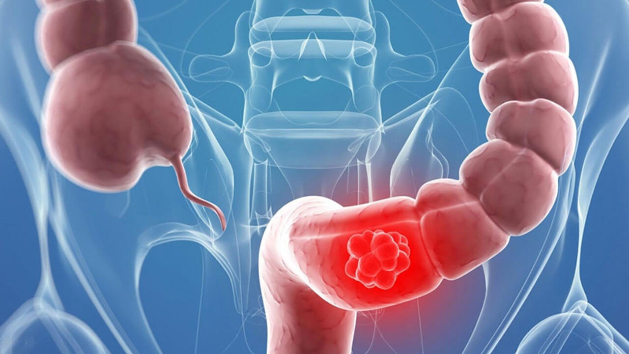 Doğal Müshil Kaynakları nelerdir