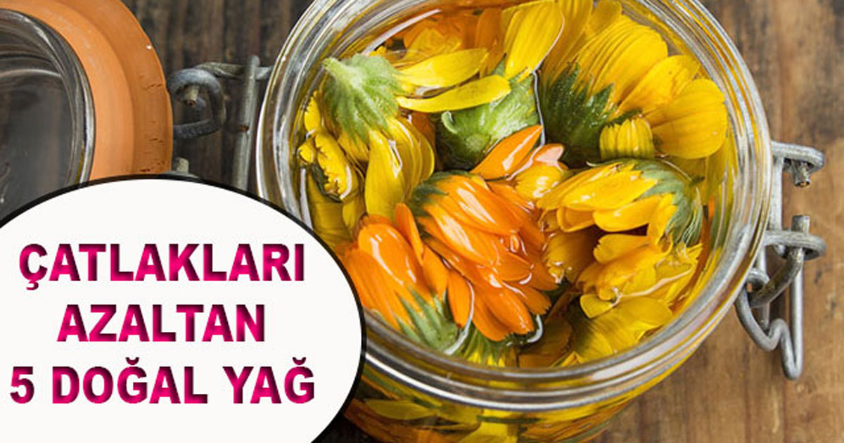 Çatlaklara iyi gelen 5 doğal yağ