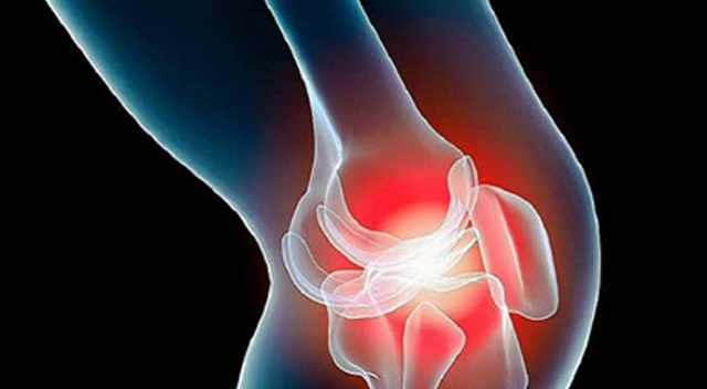 Romatoid Artrit için iltihaplı eklemler romatizma hastalıkları için kür