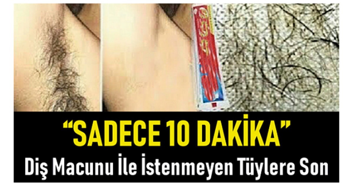 Diş Macunu Kullanarak 10 dakikada İstenmeyen Tüylerden Kurtulun