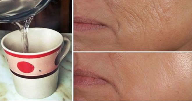 Her sabah boş bir karna bu yöntemle ılık su içtiğinizde vücudunuza olanlara inanamayacaksınız!