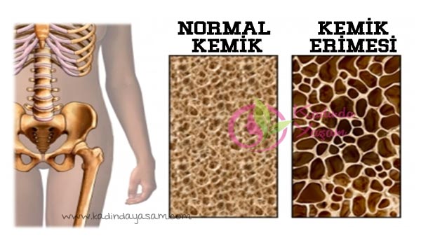 Kuru nane yoğurt kemikleri güçlendirme kürü