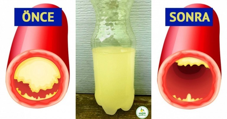 Kan Damarlarını Açacak Özel Bir İçecek Tarifi