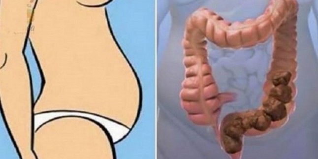 Şişman değilsiniz! Sadece bağırsaklarınızda dışkı birikmiş!