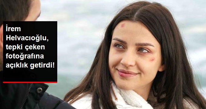 İrem Helvacıoğlu, Tepki Çeken Fotoğrafına Açıklık Getirdi