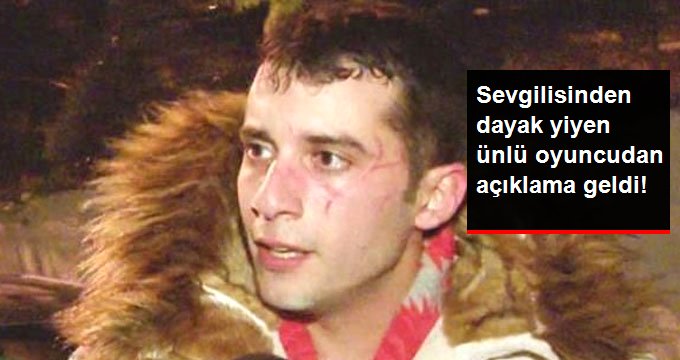 Sevgilisinden Dayak Yediği İddia Edilen Ünlü Oyuncu Açıklama Yaptı
