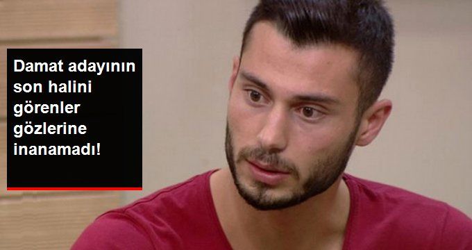 Damat Adayı Emre Ubeyli’yi, Son Halini Gören Takipçileri Tanımakta Güçlük Çekti!