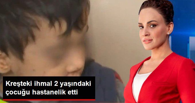 Kreşteki İhmal 2 Yaşındaki Çocuğu Hastanelik Etti