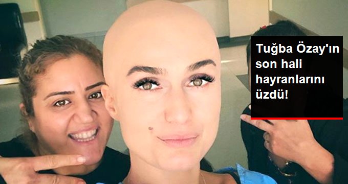 Tuğba Özay, Fotoğrafıyla Takipçilerini Endişelendirdi