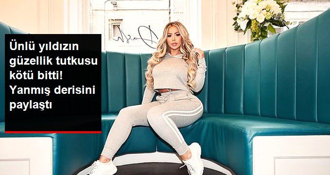 İngiliz Televizyon Yıldızı Holly Hagan’ın Lazerden Yüzü Yandı