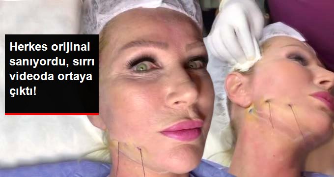 SEDA SAYAN, CANLI YAYINDA YÜZÜNÜ GERDİRDİ!