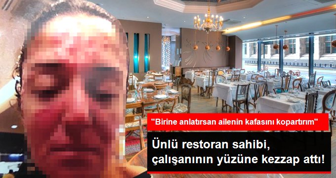 Büyük İddia: Ünlü İş Adamı, Yanında Çalışan Kadının Yüzüne Kezzap Atarak Tehdit Etti