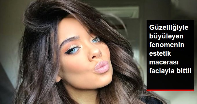 YouTube Yıldızı Cassidy Valentine’in Estetik Macerası Faciayla Bitti!